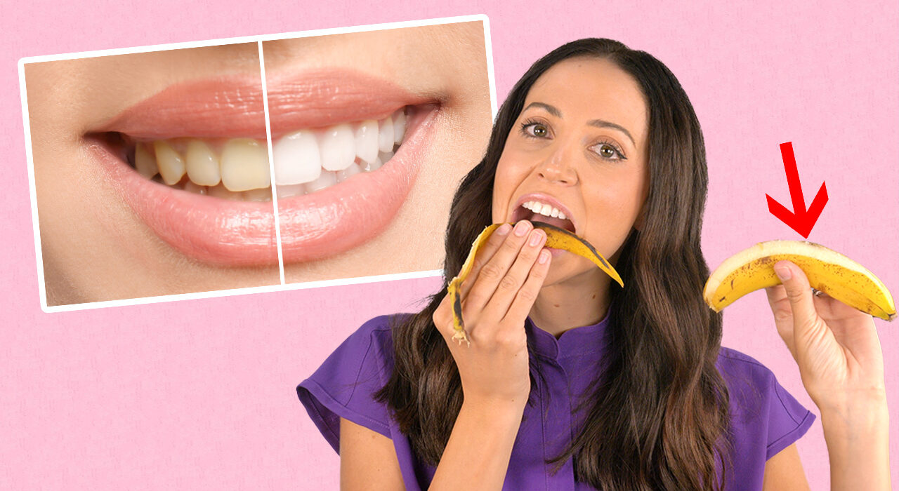 teeth_whitening_3005c27505 - Sacco Trend Magazine